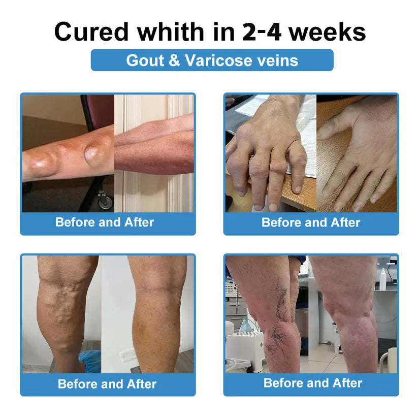 LUMIVO™ Nano-microneedle joint patch