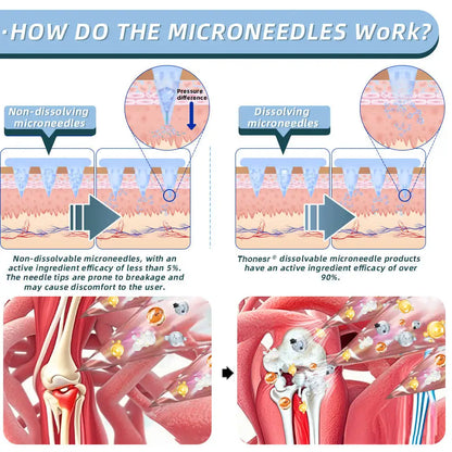 LUMIVO™ Nano-microneedle joint patch