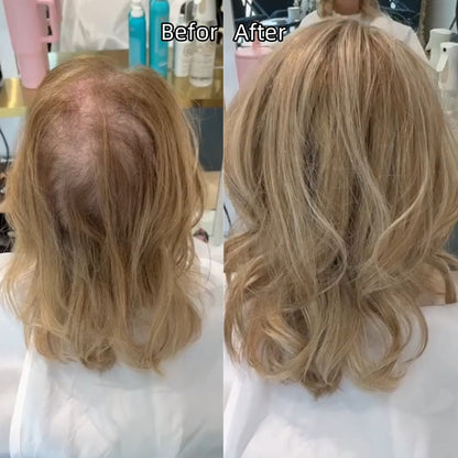 ⚡ Final Hours – Up to 41% Off🌷2026 New Lightweight & Breathable Wavy Hair Topper-100% human hair
